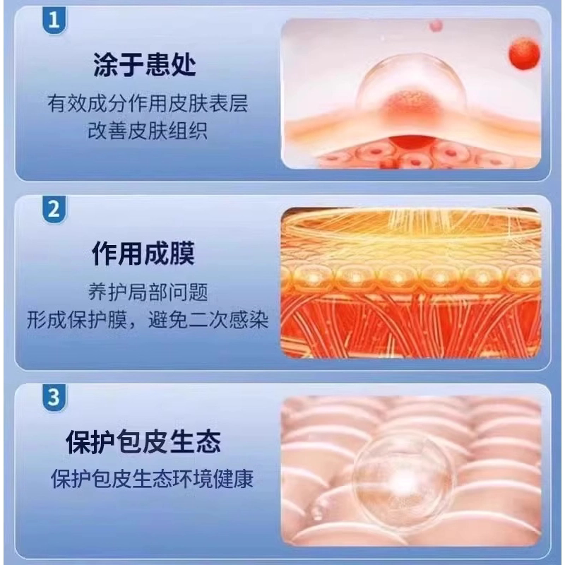 龟头包皮炎症开裂口发炎真菌感染红肿白垢破裂开龟头炎男科药膏FF，原价15.50性价比炸裂！_游戏皮肤_淘宝游戏网