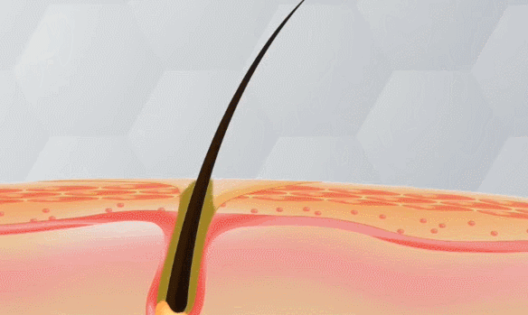 P_018.gif