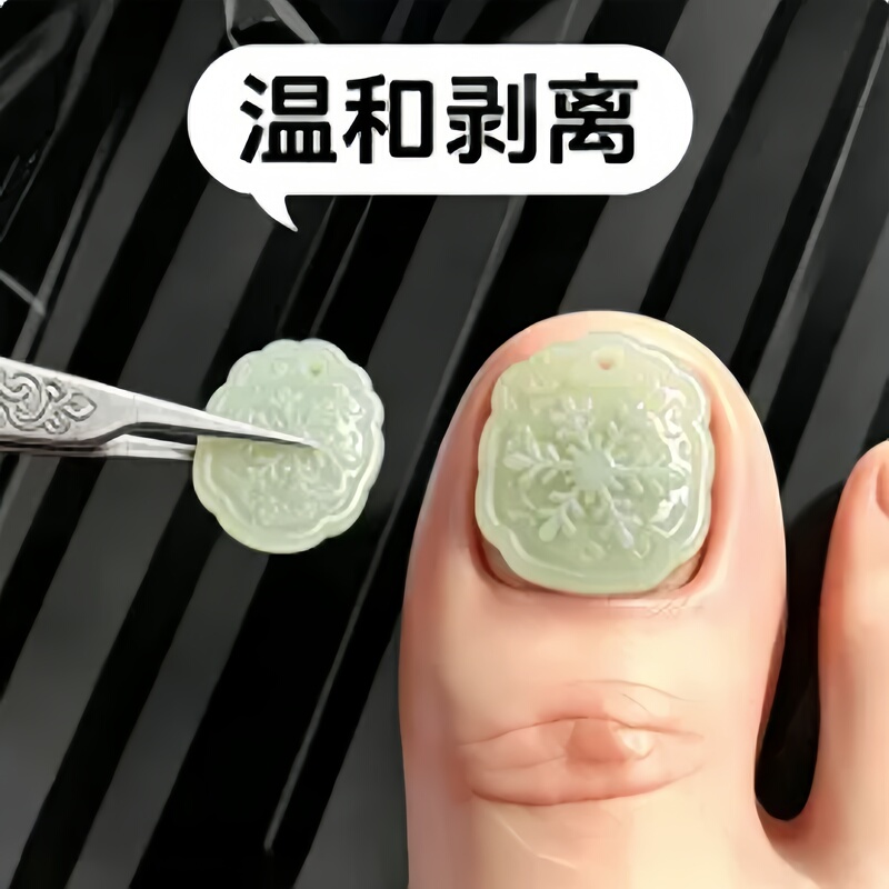 【Hot-Selling Chinese Medicine Product】Plant-Derived Special Nail Fungus Removal Patch, Universal Nail Sticker, Genuine Toe Patch 【Hot-Selling Chinese Medicine Product】Plant-Derived Special Nail Fungus Removal Patch, Universal Nail Sticker, Genuine Toe Patch