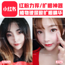 Open the corner of the eye open the corner of the eye open the corner of the eye open the corner of the eye open the corner of the eye open the corner of the eye open the corner of the eye open the corner of the eye