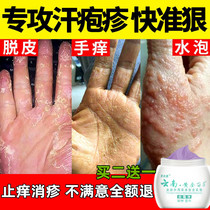 Small blisters on the hands and feet itchy hands and feet moss luck cement allergy itching peeling sterilizing sweat rash plaster