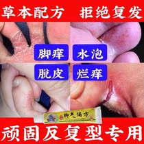 Moss foot itching antipruritic ointment sterilizing deodorant cracked feet itchy rotten feet peeling blister type special drug artifact