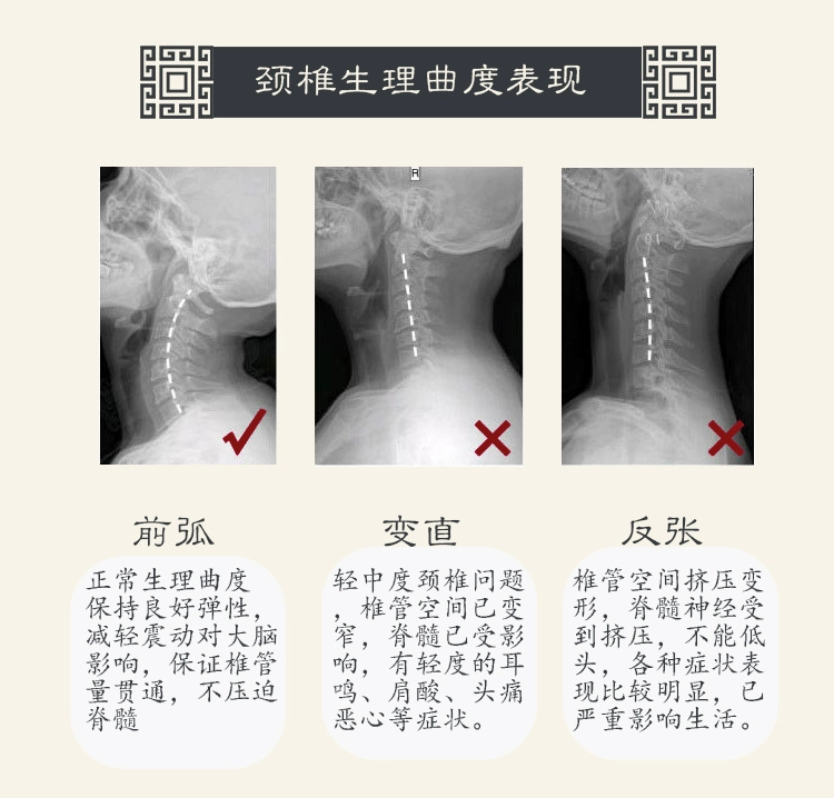 Thiếu Lâm chăm sóc sức khỏe gối để giúp giấc ngủ gối than tre thư cổ tử cung cổ đốt sống và vai cứng sửa chữa gối cổ tử cung đặc biệt - Gối