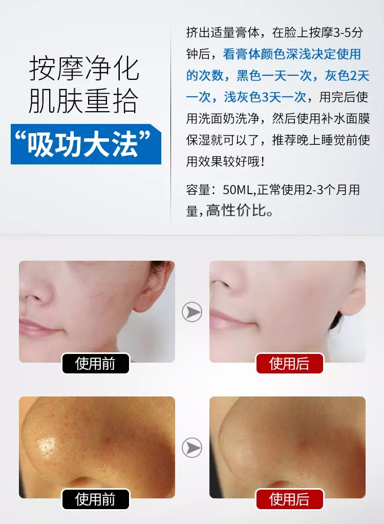 Zicai Purifying Huan Yan Toxin Massage Cream Nam và nữ Facial Deep Cleansing Pore Cream Detox Cream chính hãng - Kem massage mặt kem massage mặt nâng cơ