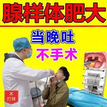 Adenoid hypertrophy in children