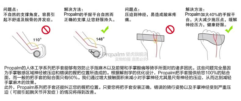 Poignées de vélo PROPALM - Ref 2351904 Image 6