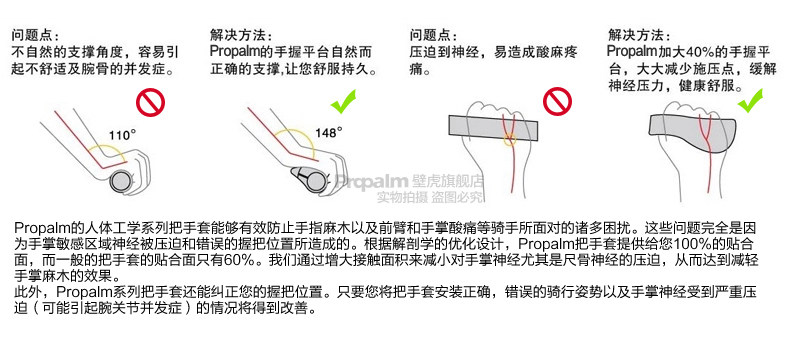 Poignées de vélo PROPALM - Ref 2341646 Image 10