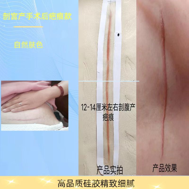 Post-Operative Scar Hyperplasia Fake Scar Film Special Effects Simulated Scar Patch Plasma Cos Simulated Suture Wound Fake Skin Post-Operative Scar Hyperplasia Fake Scar Film Special Effects Simulated Scar Patch Plasma Cos Simulated Suture Wound Fake Skin