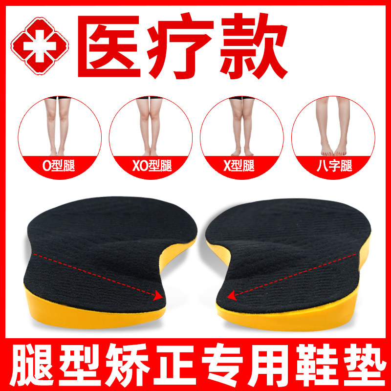xo型腿足外翻足内翻内八外八字脚矫正器鞋垫改善美腿直腿神器纠正