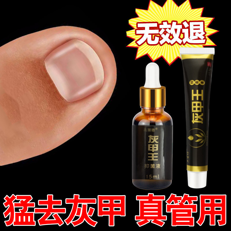 Onychomycosis root cure special medicine to repair thick nail medicine to treat nail removal cream manicure knife nail black and empty