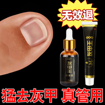Onychomycosis root special medicine to repair thick nails medicine to treat nail removal cream manicure knife nails become black and empty