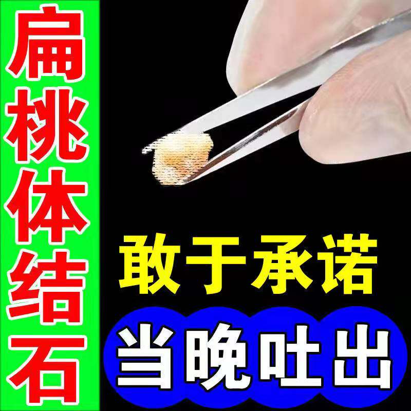 Tonsil stone removal tool to clean throat foreign body sense bad breath stone tonsil inflammation hypertrophy swelling medicine
