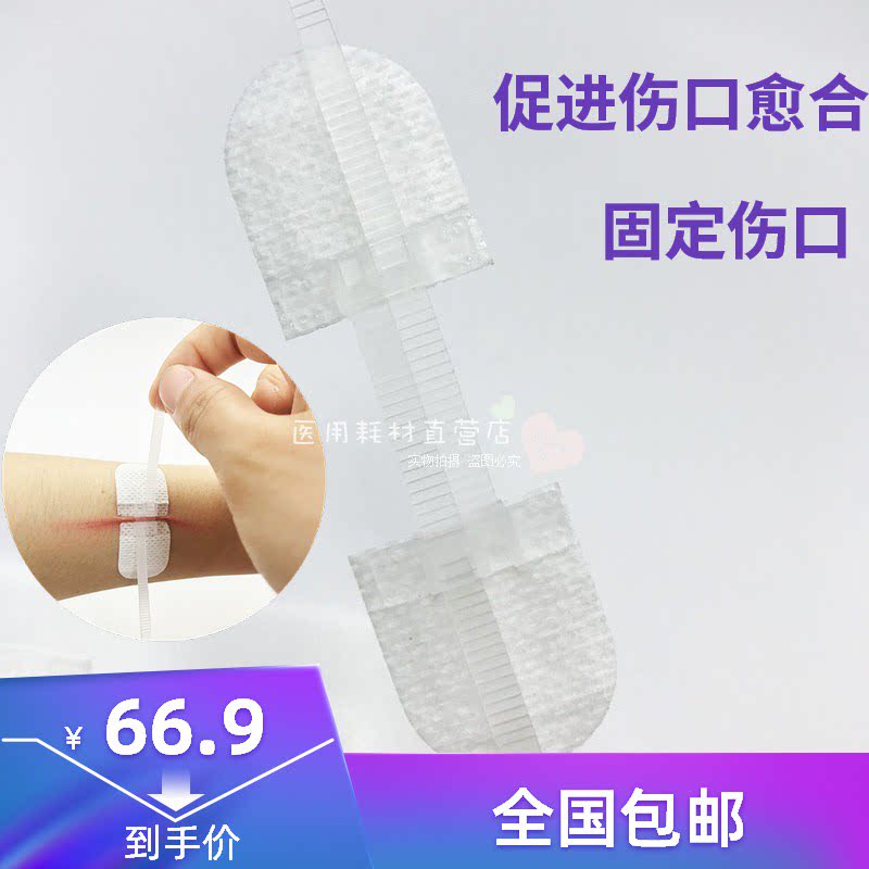 Seam-free and post-free wound suture OK stretch wound pull-up OK stretch small wound seam-free tape 1 piece