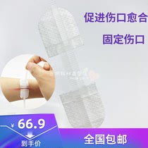 Suture-free and post-wound suture band-aid Wound pull-up band-aid for small wounds 1 piece of suture-free tape for small wounds