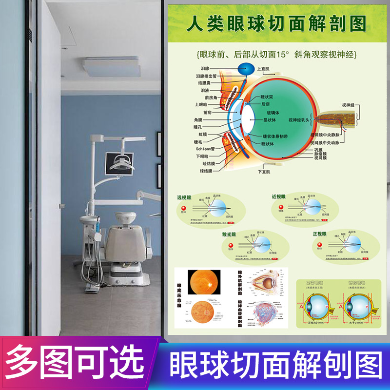 Eyeglass shop eye Eye anatomy diagram structure Eye care poster wall chart Eye exercise Eye wall sticker