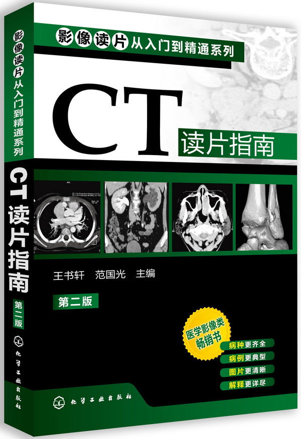 (Kangwei) CT Read-sheet Guide 2nd edition of the 2 edition of Wang Shuxuan Image Reading Film From Getting Started to Proficient in Series Chemical Industry Press