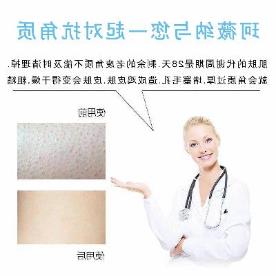 珂薇纳去角质死皮鸡皮面部手足全身美白护肤清洁搓泥磨砂膏男女水