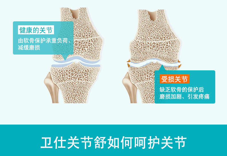 Mua 1 tặng 2 mới Wei Shi chung Shu dog dog trong con chó lớn chondroitin thiếu canxi gãy chân 160 miếng - Cat / Dog Health bổ sung sữa cho mèo mới đẻ