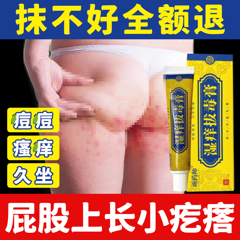 Pimples and Itches on the Buttocks, Itching from Sitting for Long Periods, Itching Cream, Wet Itching, Detoxifying Heat and Toxins, Red Bumps, External Use on the Skin