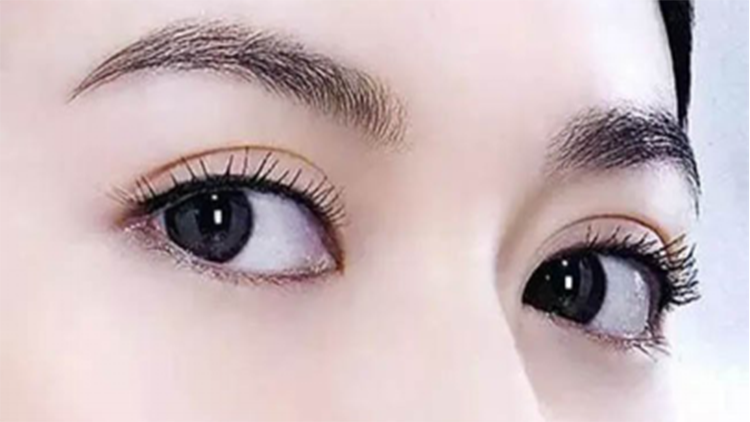 想要有美美的双眼皮起床时就要注意了
