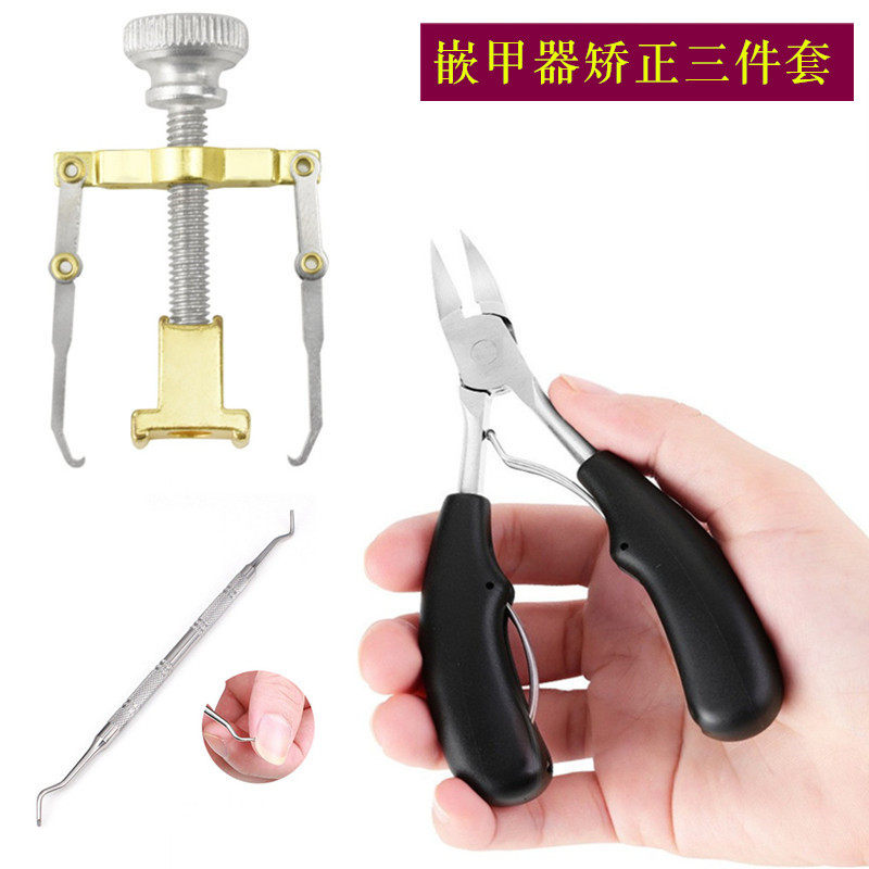 Nail ditch inlay device corrects inflammation is nail stick ditch toenail nails long flesh embedded artifact correction manicure special