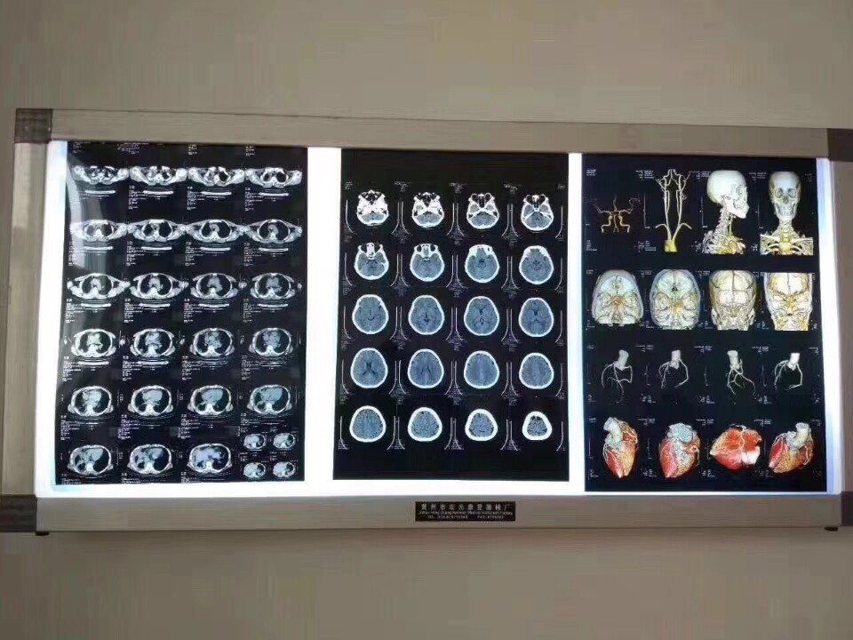 Radiographic dry film inkjet thermal DR CT X-ray 3D reconstruction blue sheet white sheet print film paper