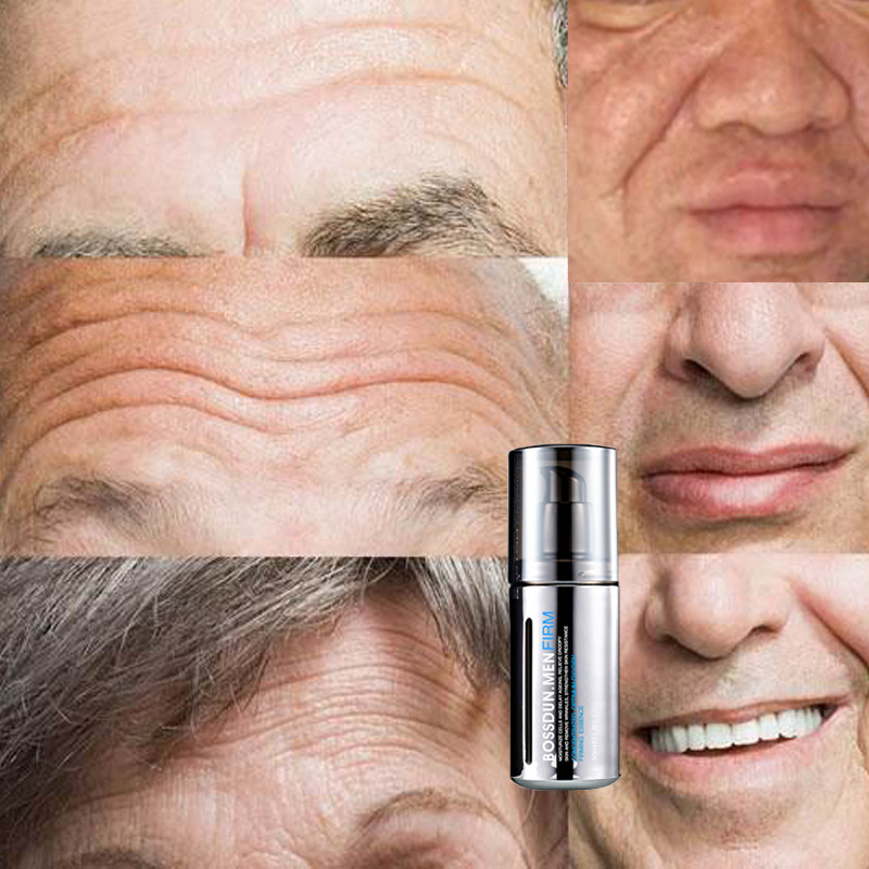 Remove forehead lines and wrinkle men's anti-aging essence dilute wrinkles and fine lines lift and firm the nerve organ network