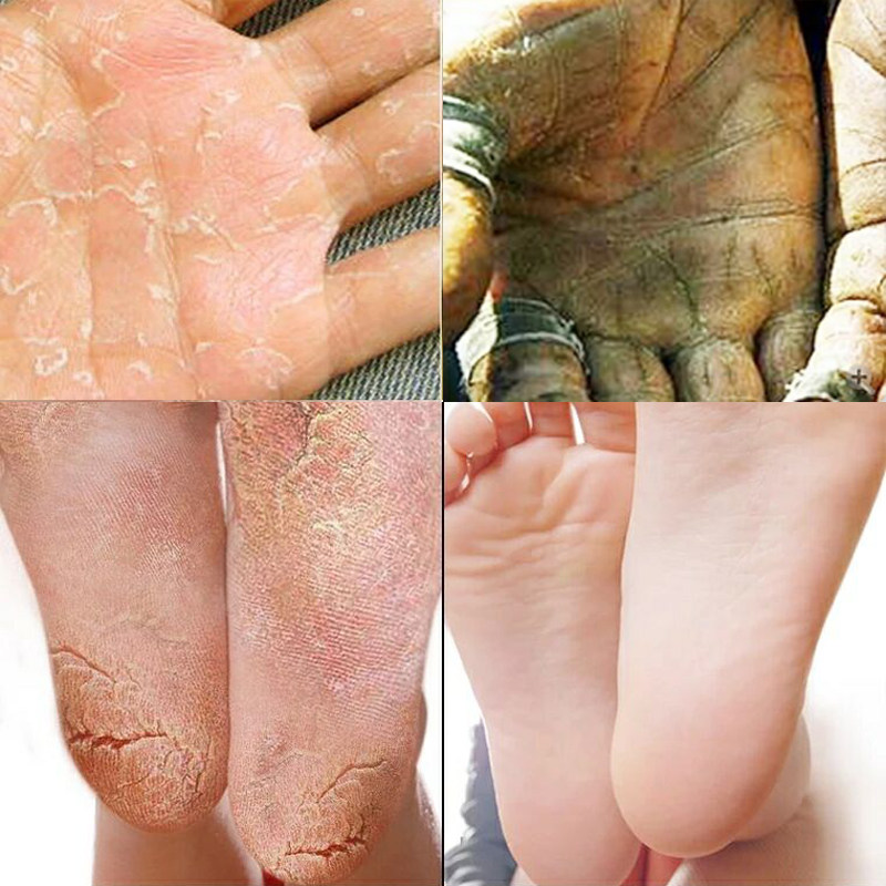 Men's autumn winter hand cream moisturizing anti-cracking and anti-peeling hand rough keratine dead skin clear and moisturizing not greasy