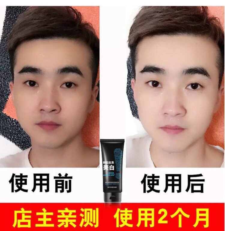 Sun-dark post-whitening repair for men's exclusive wash-face cream Withdrawal Melanin for Acne Removing Acne and Acne Prints and Acne