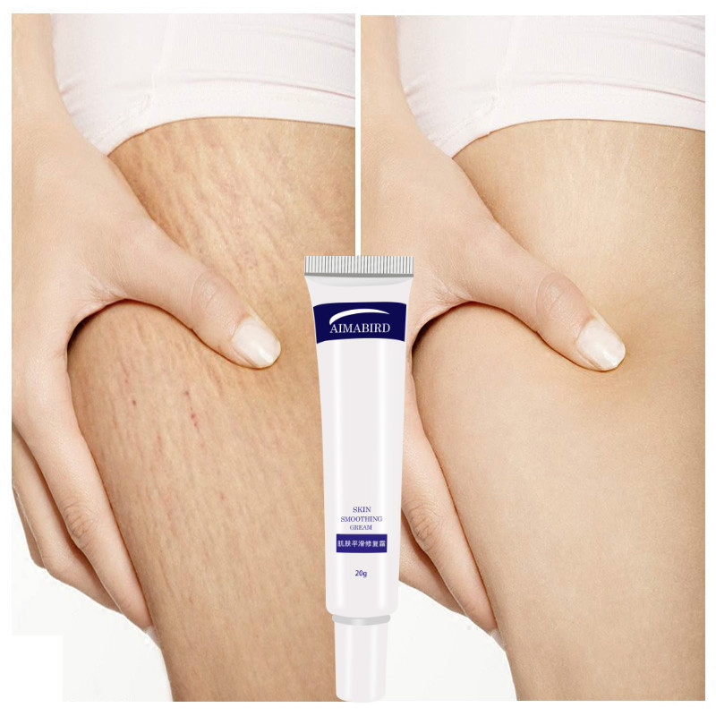 Dress-up special to pregnant men and women pattern spots to eliminate firming prevention and repair cream to remove obesity pattern false mother supplies