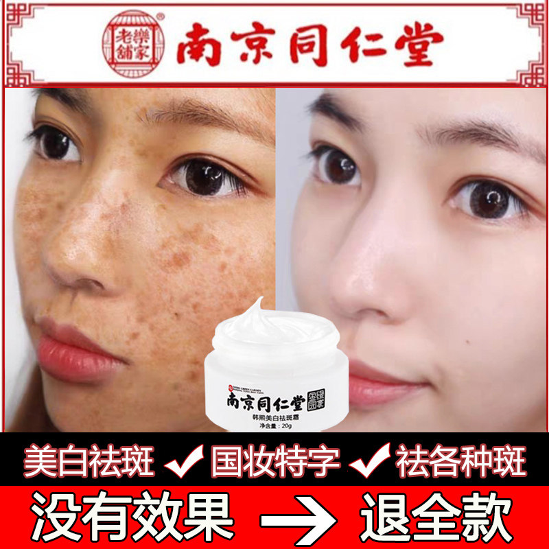 Nanjing Tongrentang freckle cream to lighten freckles, freckles, chloasma, age spots, dark spots, whitening and spot removal artifact