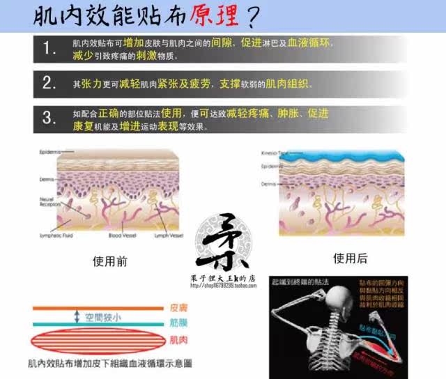 Protection sport - Ref 585328 Image 13