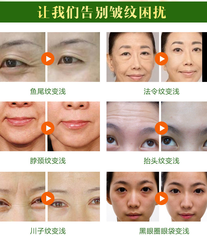 Tinh chất chống nhăn nâng nếp nhăn làm săn chắc da mặt Chống nhăn tinh chất vàng ohui