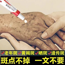 Senile plaque powerful removal of disspot cream yellow brown spotted with melanin hand facial official flagship store