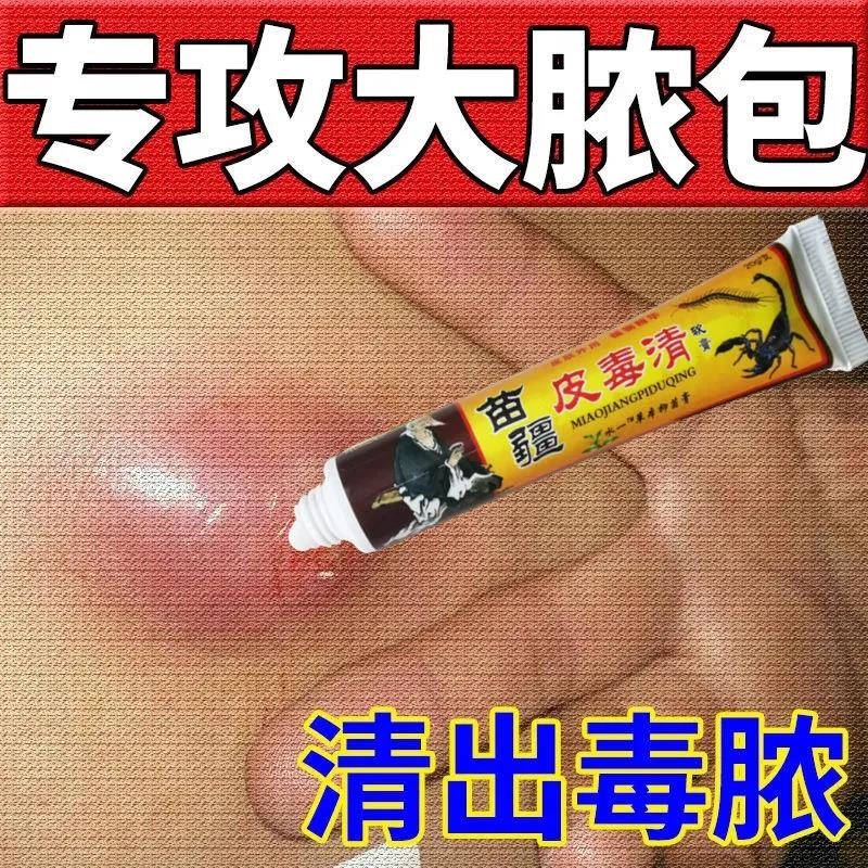 Miaojiang fire boils pull poison, pull Yin pull pus cream, red and swollen pimples, hard lumps, sore buttocks, boils, pus suction artifact