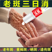 Age spot strong removal freckle cream chloasma freckles remove melanin hand face official flagship store