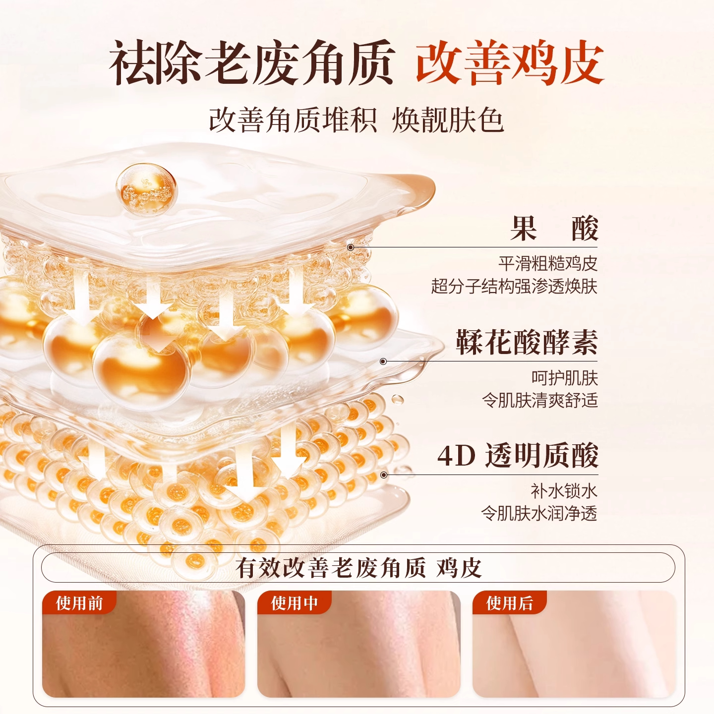 lzq果酸沐浴露祛痘润保湿滋润留香成人男士女正品官方品牌授权lzp真的值得买吗？_沐浴露_淘宝美妆网