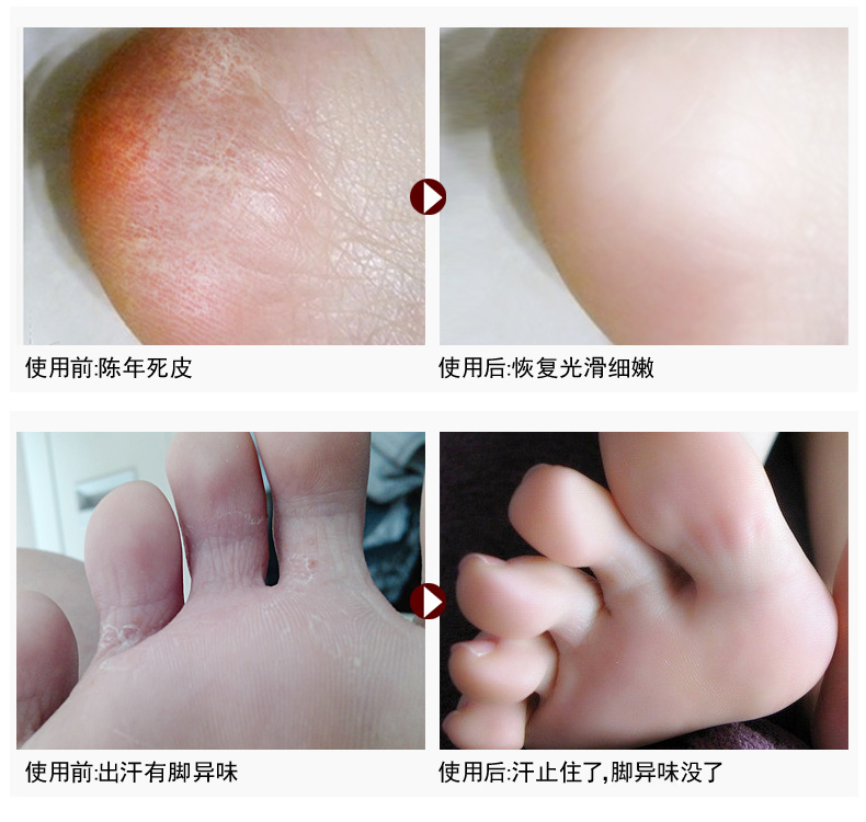 Muối ngâm chân ngâm chân ngứa để đi đến muối tẩy trắng chân cũ để tẩy tế bào chết để loại bỏ muối ngâm chân để ngăn ngừa nứt chân chăm sóc chân kem dưỡng trắng da tay chân