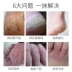 Kem chăm sóc chân Kem làm trắng da Bàn chân tẩy tế bào chết Tẩy tế bào chết Kem cũ Foot Film Film Scrub Foot Cream trị nẻ chân Trị liệu chân