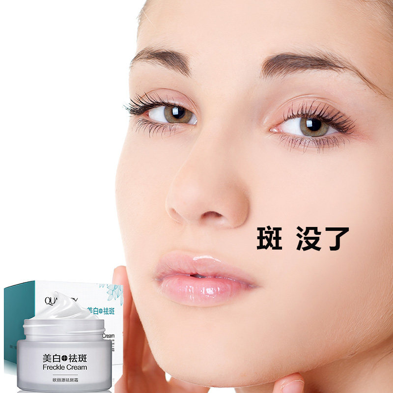 Disspot cream Facial Freckles genetic yellowness Brown Spotted Skin Whitening Pale Speck Deity To Spot Products