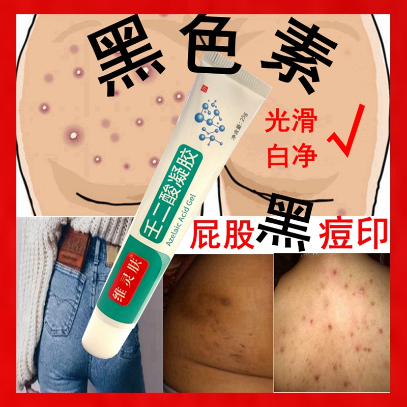Remove Black Acne Marks on the Buttocks, Remove Black Marks and Black Sitting Marks, Remove Black Acne Marks on the Back, Fade and Eliminate Melanin Deposits, Small Pimples