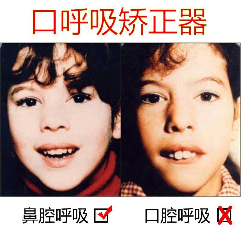 Japan's children's mouth suction correction deity prevents Zhang's mouth from sucking up the snore and snoring to sleep and shut up and seal the lips