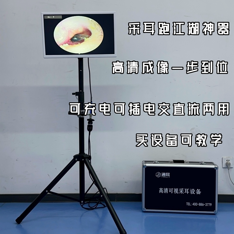 High-Definition Visual Ear-Picking Equipment, Specialized for Outdoor Stalls and Traveling Sales, with a High-Brightness Large Screen and Rechargeable Visual Device