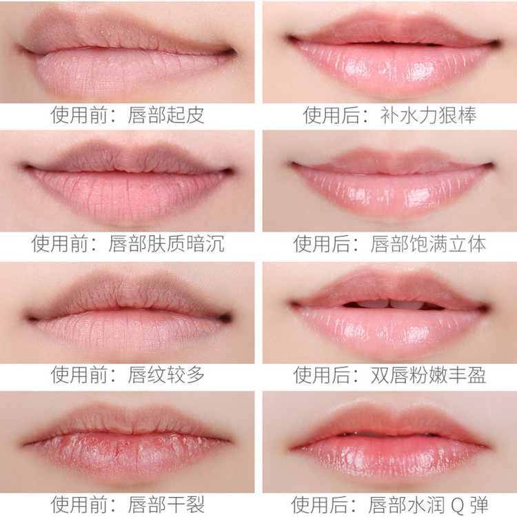 moisturizing lip balm 4g