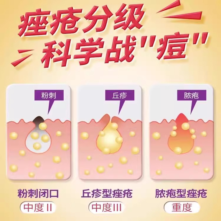 九鑫清热暗疮丸：痘痘界的“救火队长”-皮脂汗腺-淘宝好物网