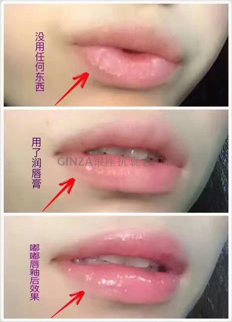 Cao hơn 20% so với bạc, Son bóng môi Nhật Bản 60 lần axit hyaluronic, môi, môi, môi, màu xanh - Son bóng / Liquid Rouge 	son bóng amuse