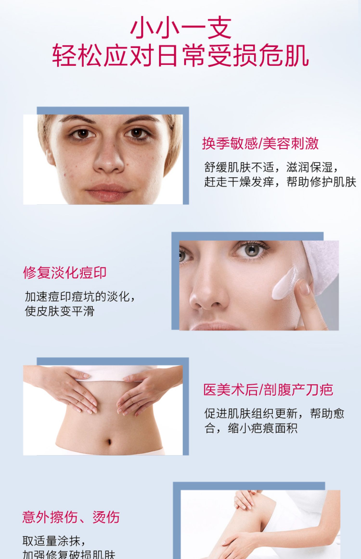 ISDIN Tôi nghĩ B5 đa tác dụng làm mờ dần mụn trứng cá sửa chữa kem nhạy cảm kem dưỡng ẩm cơ bắp sửa chữa - Kem dưỡng da kem dưỡng ẩm nivea soft