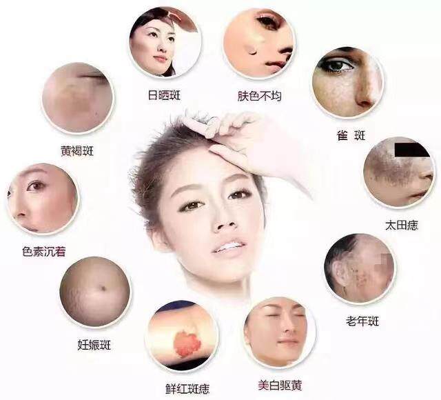 斑痘敏厂家直销