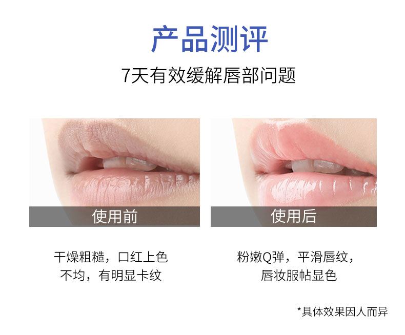 【日本直邮】SHISEIDO资生堂 MOILIP修保湿修复型润唇膏 8g