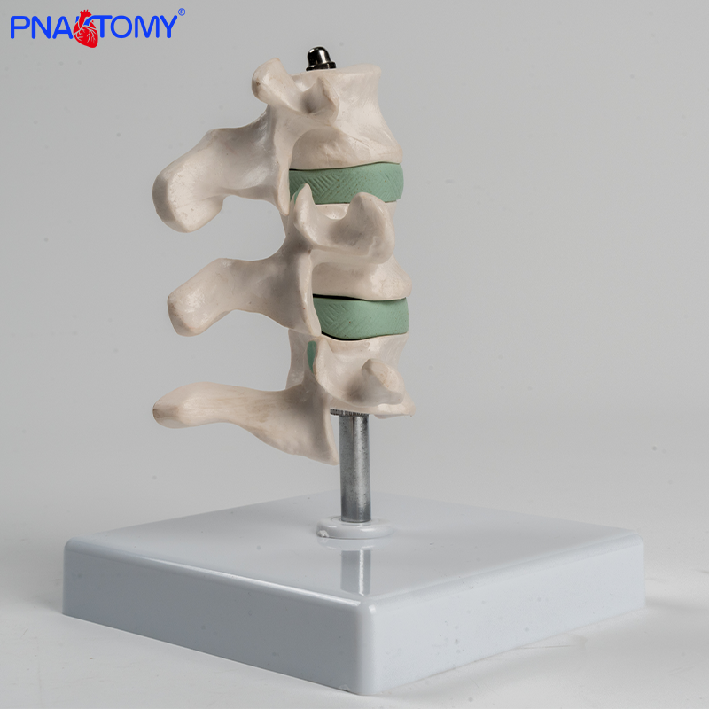 人体骨质疏松解剖模型健康动态骨质模型医学教学脊椎骨架脊柱骨骼